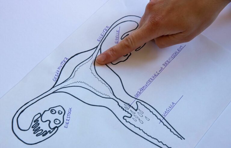Finger zeigt auf eine Gebärmutter Illustration